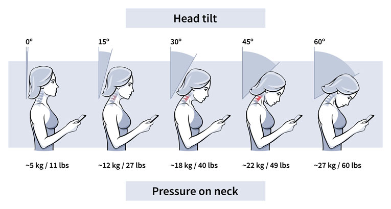 why-is-my-neck-stiff-how-do-i-fix-this-stephen-fitness